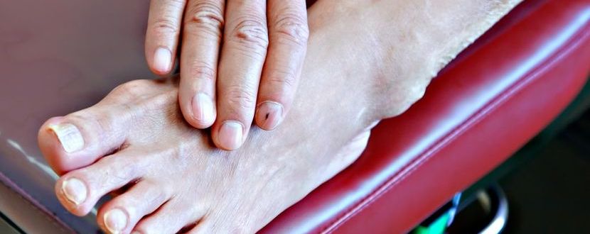 Krankheitsbedingte Schmerzen in den Füßen mit Cannabidiol entgegenwirken.