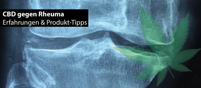 cbd gegen Rheuma und rheumatoide Arthrtis