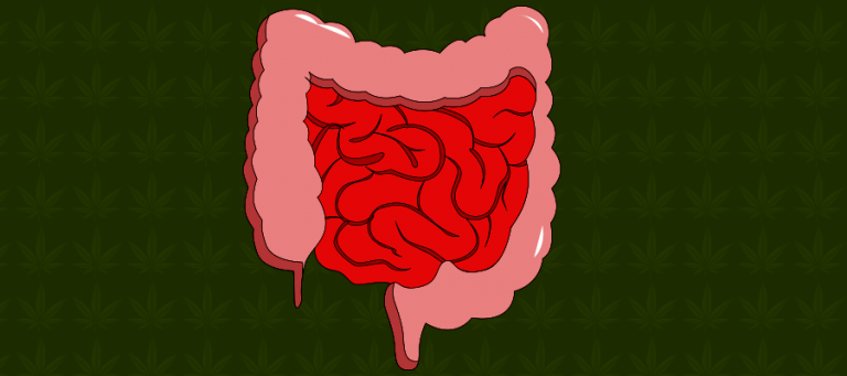 CBD bei Morbus Crohn