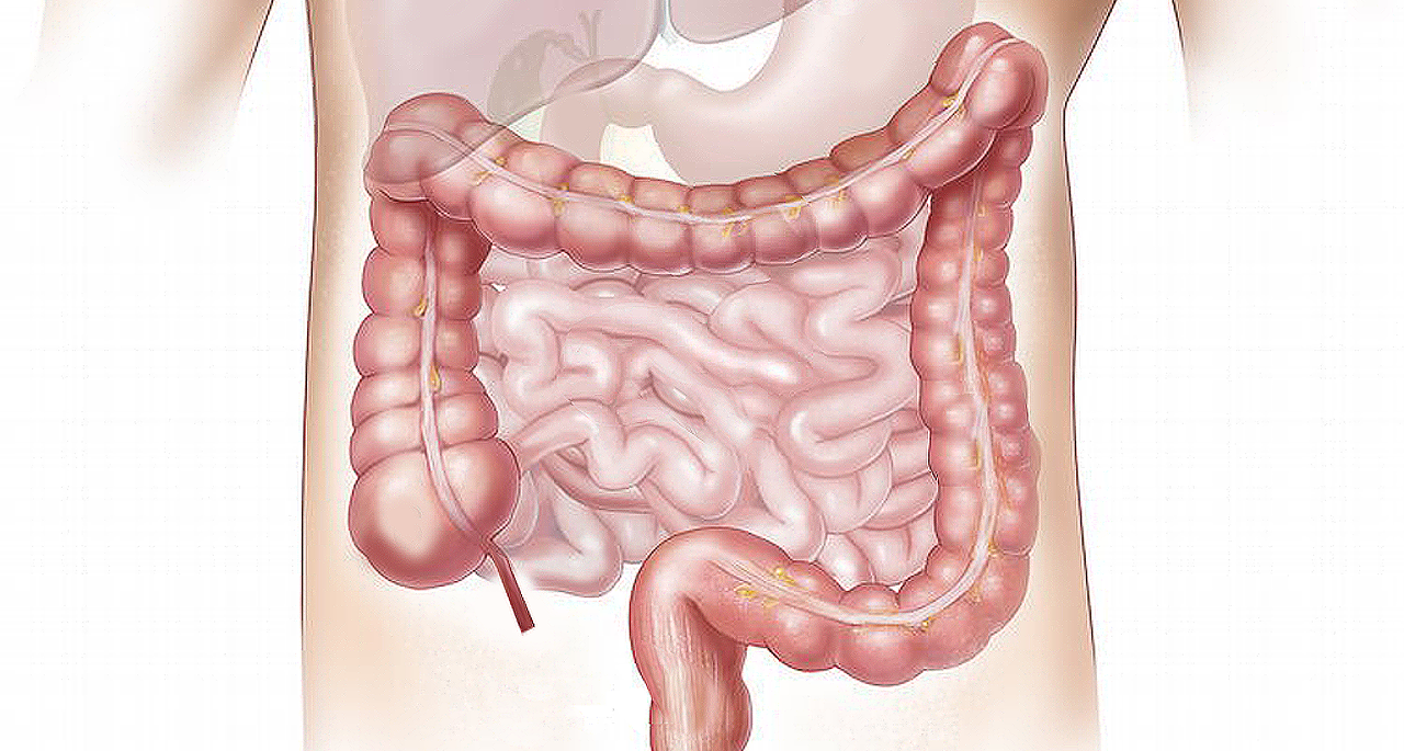 Warum kann CBD-Öl bei Reizdarm wirksam sein
